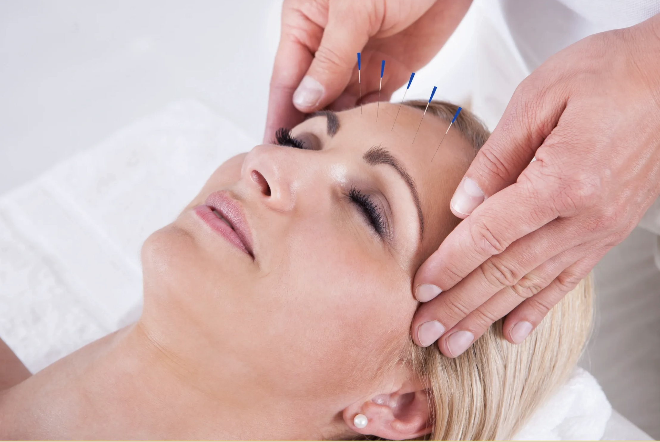 Dr. Yasmin Harounian preparing sterile acupuncture needles for treatment in Los Angeles